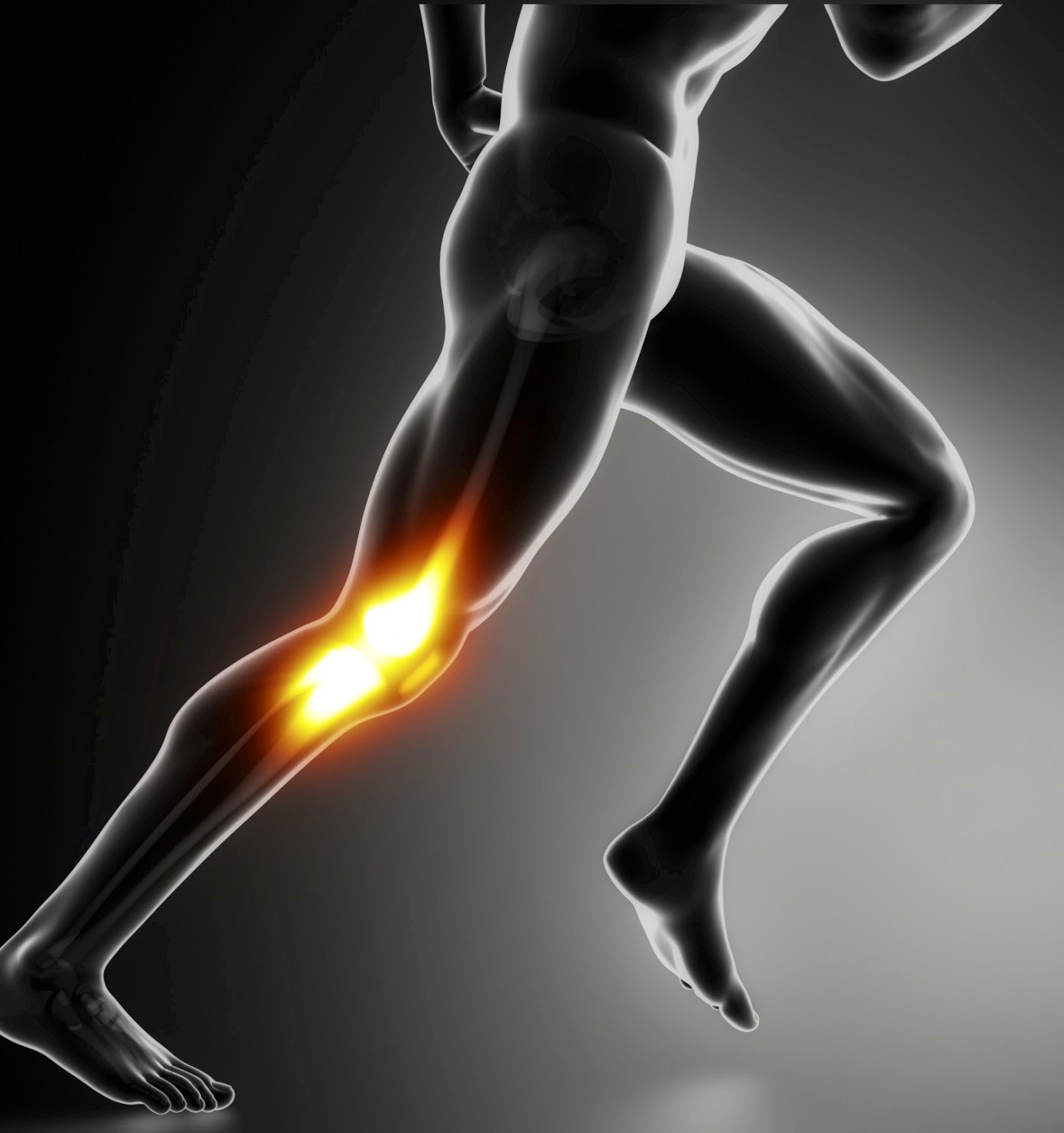LESIONES DEPORTIVAS